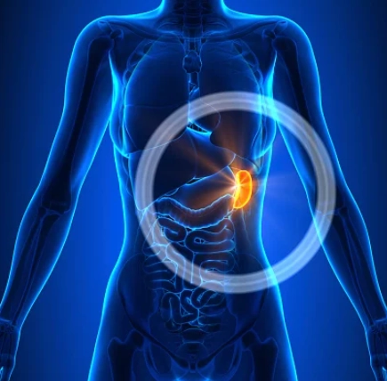 Nhồi máu lách (Splenic infarction)