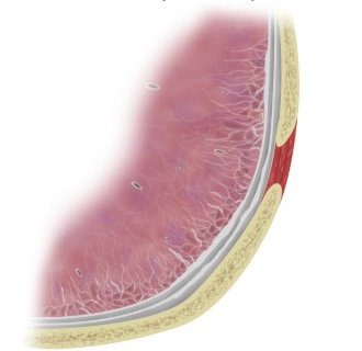 Bệnh bụi phổi amiăng (Asbestosis) 