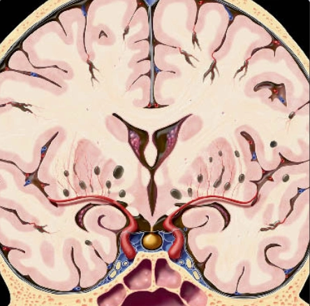 Khoang quanh mạch (Perivascular spaces - PVSs)/Khoang Virchow-Robin (Virchow-Robin spaces)