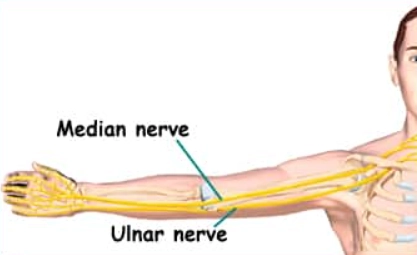 Tổn thương thần kinh giữa ở khuỷu (Median Nerve Injury, Elbow)