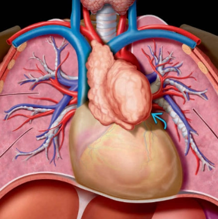 U tuyến ức (Thymoma) 