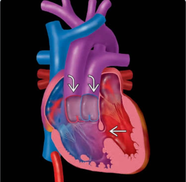 Thất phải hai đường ra