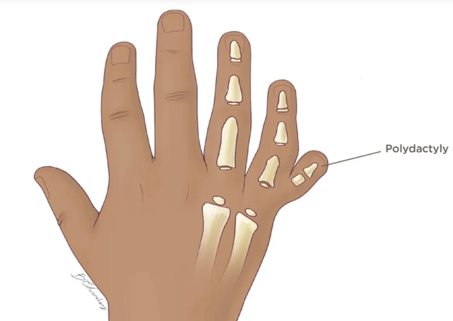 Bất thường chi thai quý I