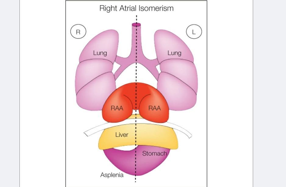 Đồng dạng phải