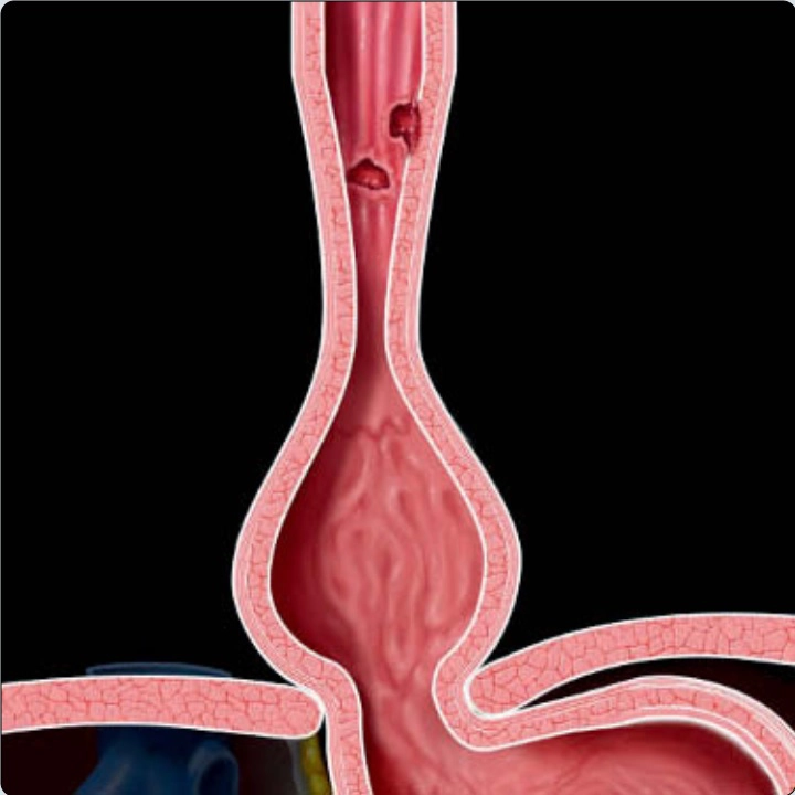 Thực quản (esophagus)