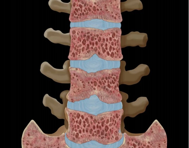Bệnh lý chuyển hóa &amp; Huyết học xương (Metabolic &amp; Hematologic Bone Disease)