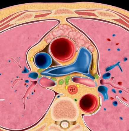 Tăng sản tuyến ức (Thymic Hyperplasia)