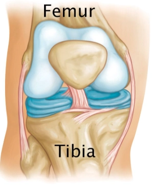  U xơ sụn nhầy (Chondromyxoid fibroma - CMF)