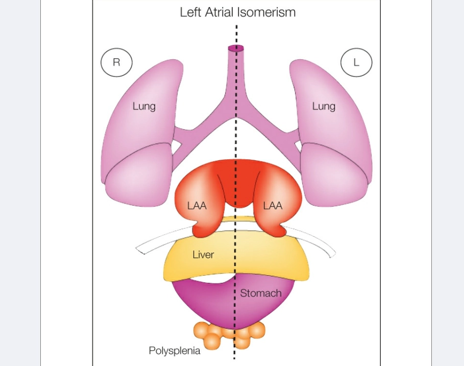 Đồng dạng trái