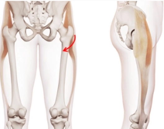 Hội chứng khớp háng kêu (Snapping hip syndrome)