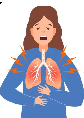 Bệnh cơ trơn mạch bạch huyết (Lymphangioleiomyomatosis - LAM)