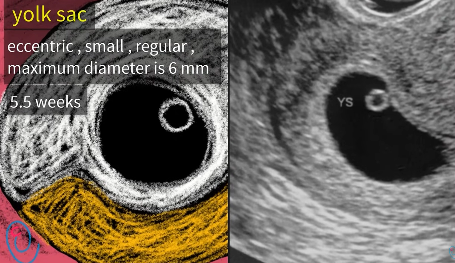 Thai 5,5 tuần: Yolk sac