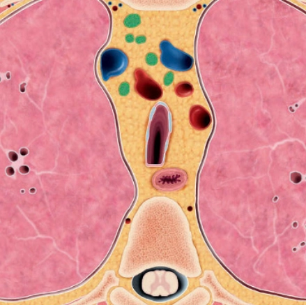 Khí quản hình vỏ kiếm (Sabre-sheath trachea)