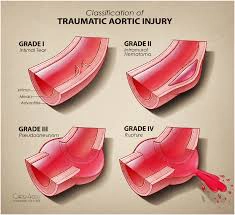 Chấn thương Động Mạch Chủ (Traumatic Aortic Injury)