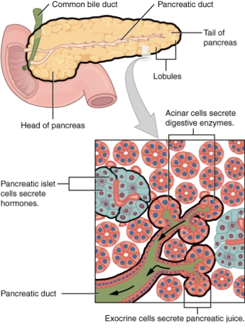 Ung thư biểu mô tế bào nang tuyến tụy (Pancreatic Acinar Cell Carcinoma - ACC)