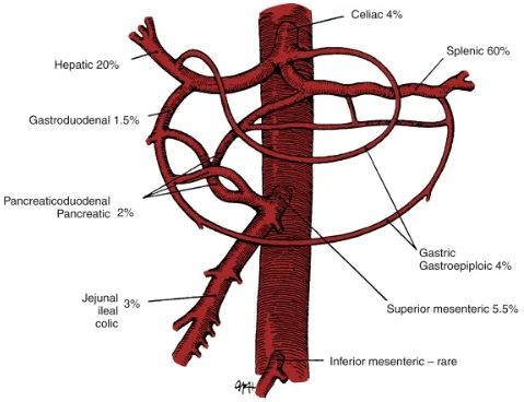Phình động mạch tạng (Visceral Artery Aneurysms - VAA)