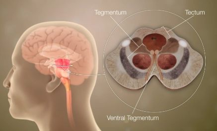 THIỂU SẢN TIỂU NÃO (CEREBELLAR HYPOPLASIA)