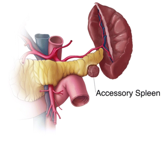 Lách phụ (Splenunculus)