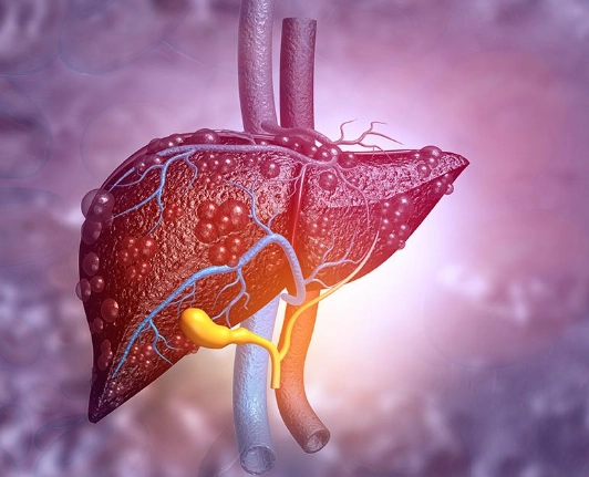 Viêm gan cấp  (Acute hepatitis)