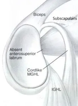 Phức hợp Buford (Buford complex)