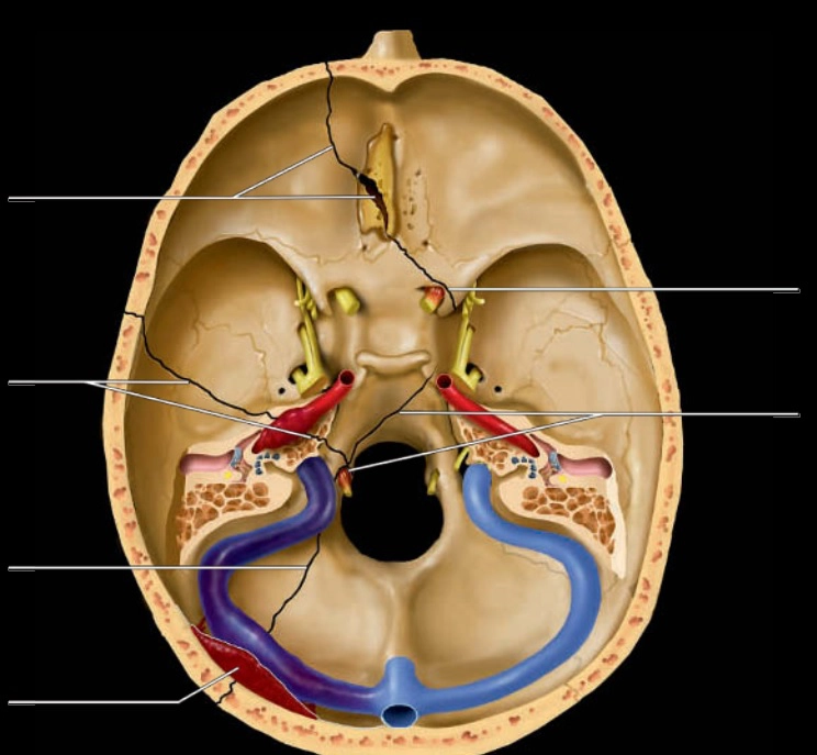 Hố yên và nền sọ giữa (Sellar &amp; parasellar)
