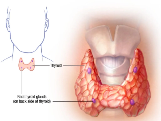Cường cận giáp (biểu hiện ở xương)(Hyperparathyroidism)