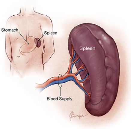Lách to (Splenomegaly)