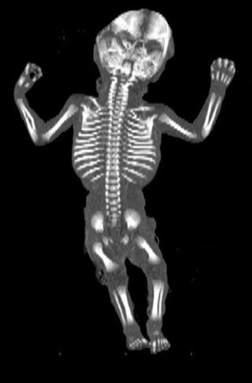 Giải phẫu siêu âm cơ xương khớp quý I