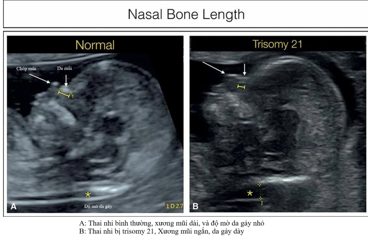 Các chỉ số của khuôn mặt