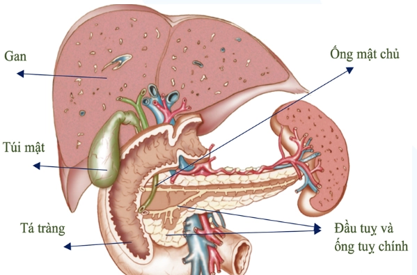 Carcinoma nang tuyến nhầy của tụy (Mucinous Cystadenocarcinoma - MCAC)