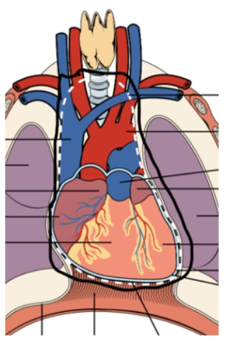 Tràn khí trung thất (Pneumomediastinum)