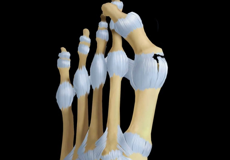 Bàn chân &amp; Cổ chân (Foot &amp; Ankle)