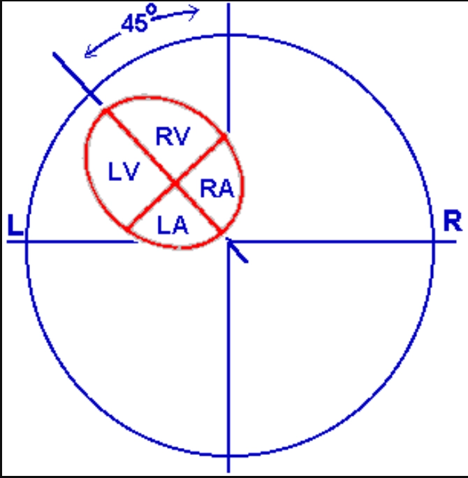 Bất thường vị trí tim
