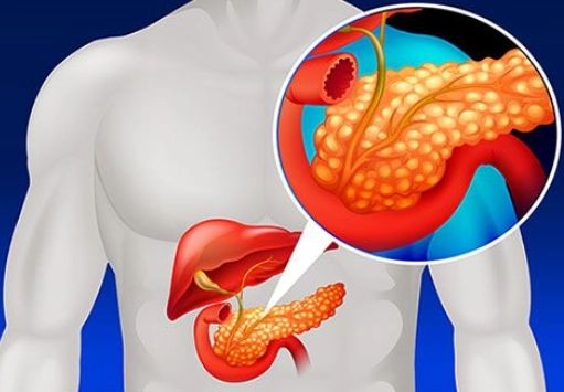 Lymphoma tụy (Pancreatic Lymphoma)