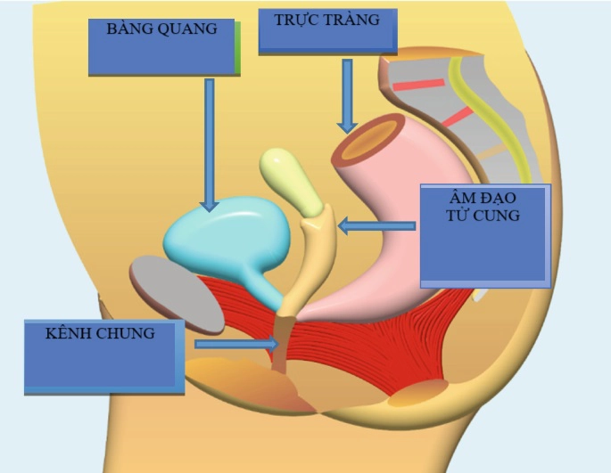 Lộn bàng quang (Bladder exstrophy)