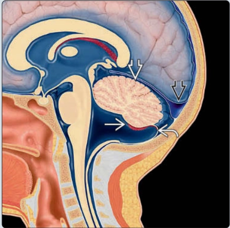Nang túi Blake ở thai