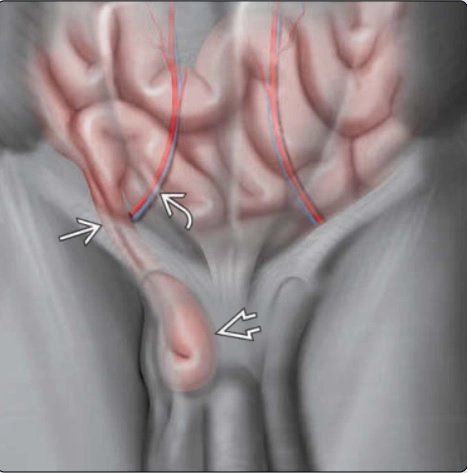 Mạc treo - mạc nối - phúc mạc - thoát vị (The Mesentery, Omentum &amp; Peritoneum)