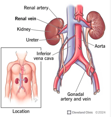 Biến thể tĩnh mạch thận (Renal vein anomalies)
