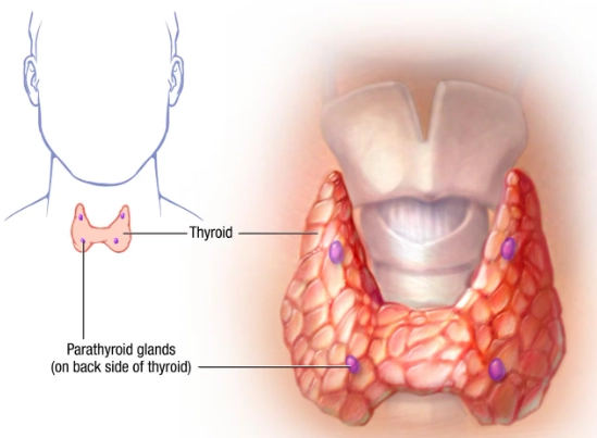 Suy tuyến cận giáp- Biểu hiện ở não (Hypoparathyroidism) 