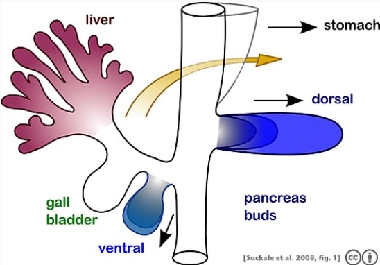 Bất sản tụy lưng (Agenesis of the Dorsal Pancreas)