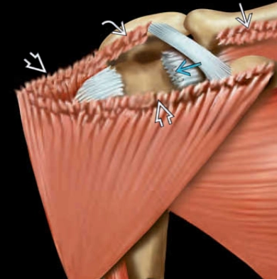 Tổn thương cơ delta (Deltoid Muscle Injury)