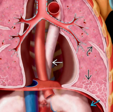 Erdheim-Chester disease (pulmonary manifestations)