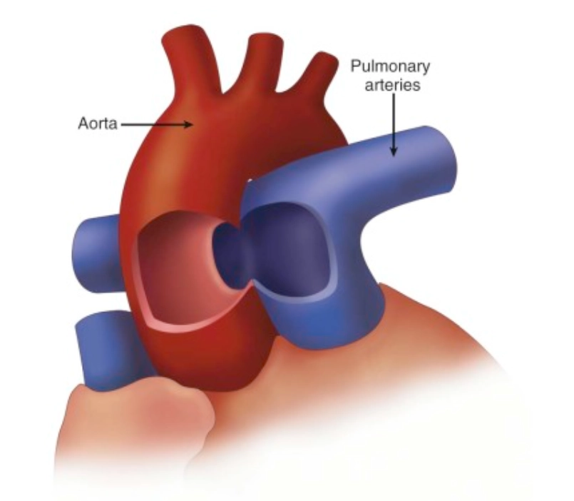Cửa sổ phế chủ
