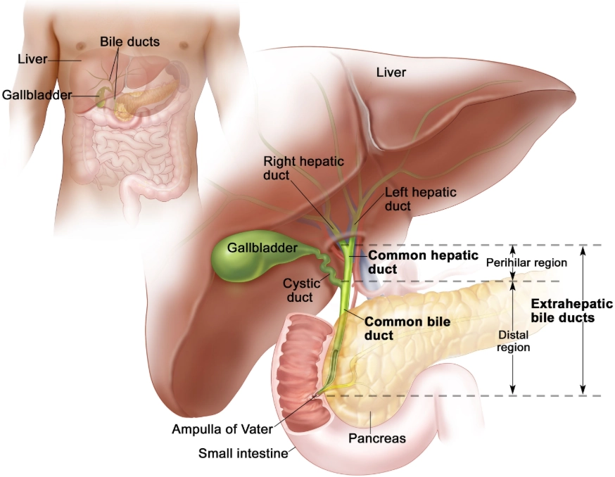 Phân loại giai đoạn u đường mật vùng rốn gan Klatskin (Perihilar cholangiocarcinoma (staging))