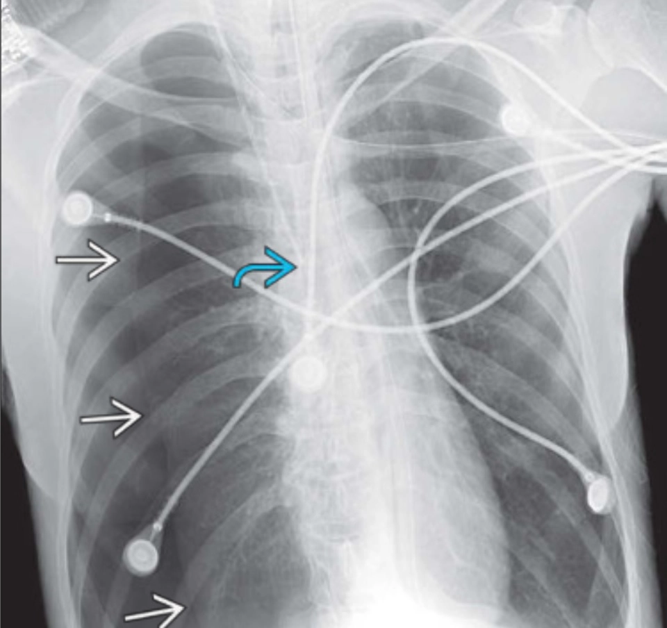 Hình ảnh ICU và thiết bị hỗ trợ (ICU imaging &amp; support devices)