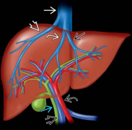 Biến thể giải phẫu động mạch gan (Variant hepatic arterial anatomy)