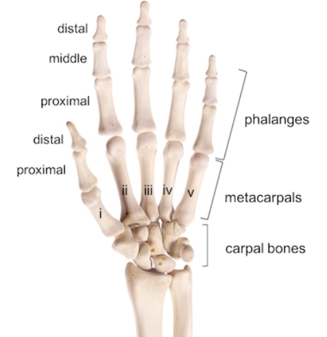 Gãy xương bàn tay (Metacarpal fracture)