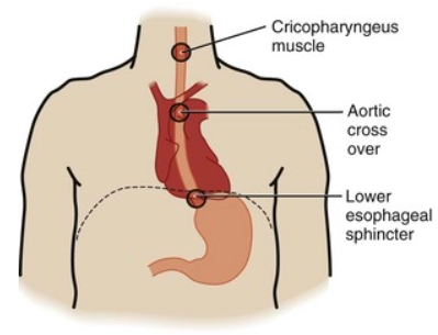 Dị vật thực quản (Esophageal Foreign Body)