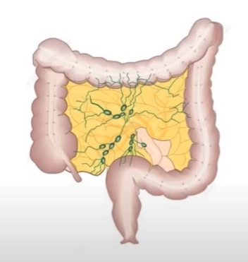 Viêm hạch mạc treo (Mesenteric adenitis)