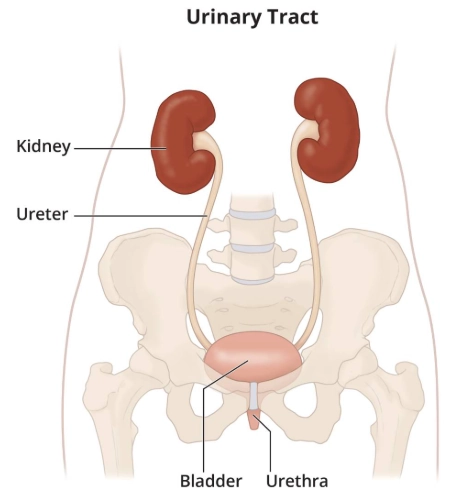 Thận lạc chỗ vùng chậu (Pelvic kidney)